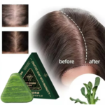 7 Roots Shampoo Bar – Anti Hair Fall & Dandruff Care Shampoo - Image 2